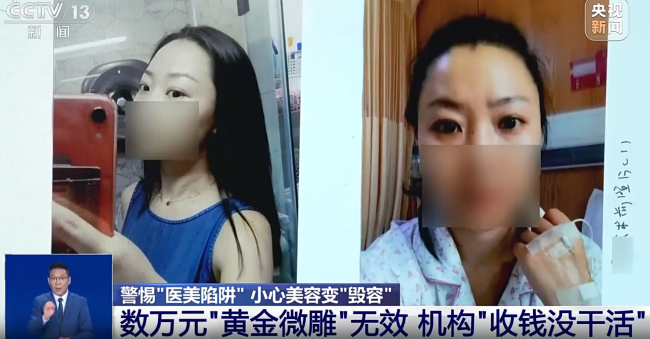 女子花5万割双眼皮术后0变化 医美机构欺诈被判赔
